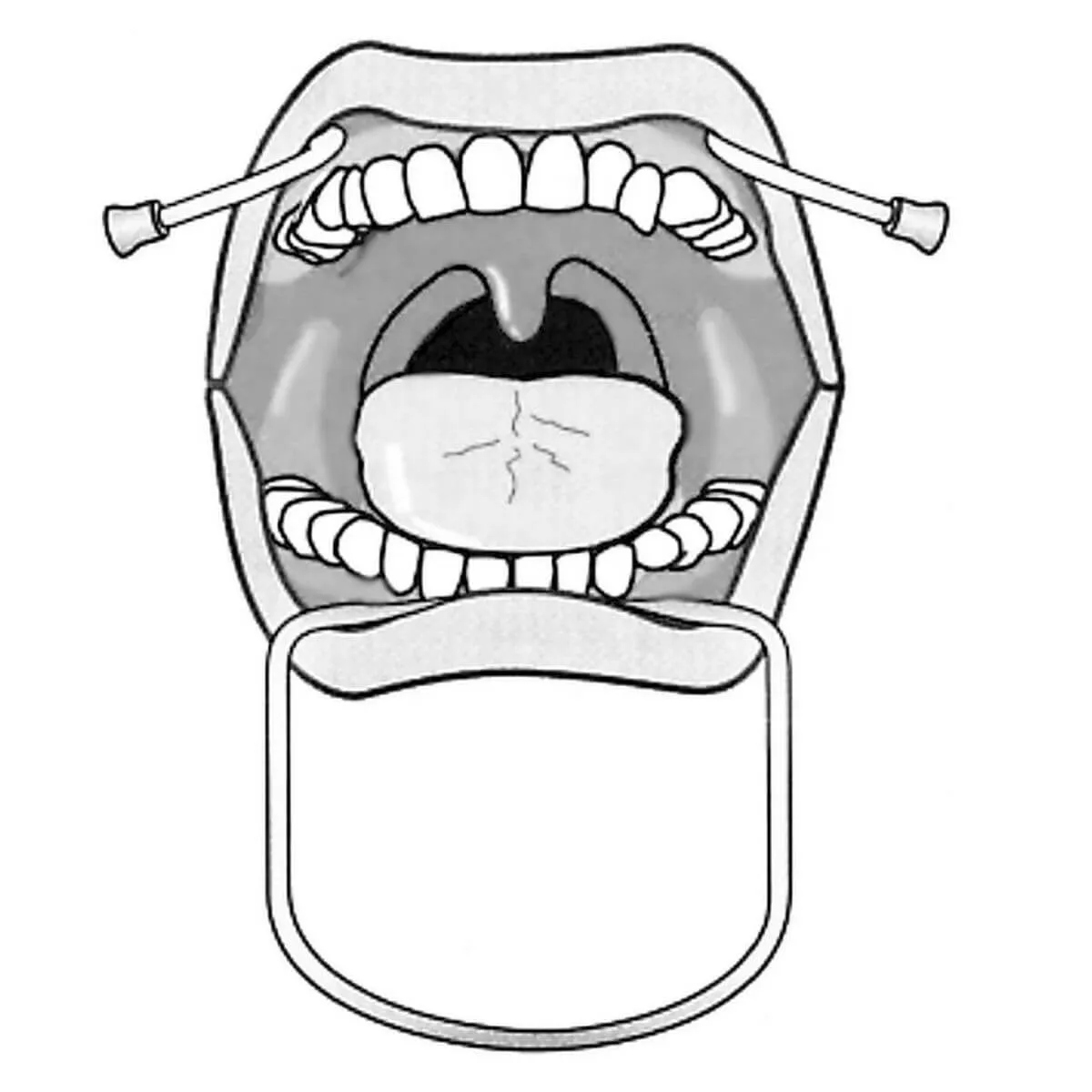 Orringer Cheek Retractor Medium
