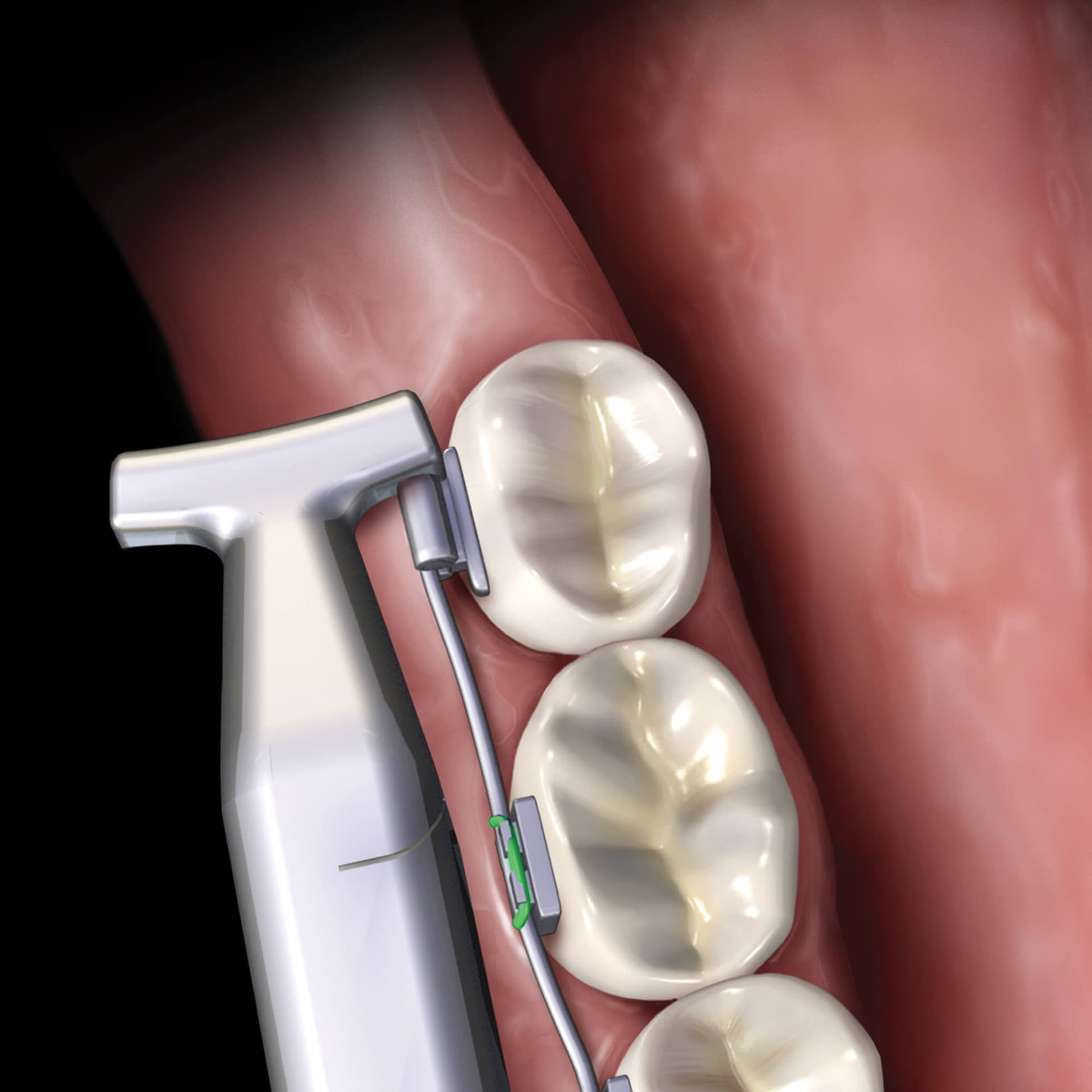صورة المنتج