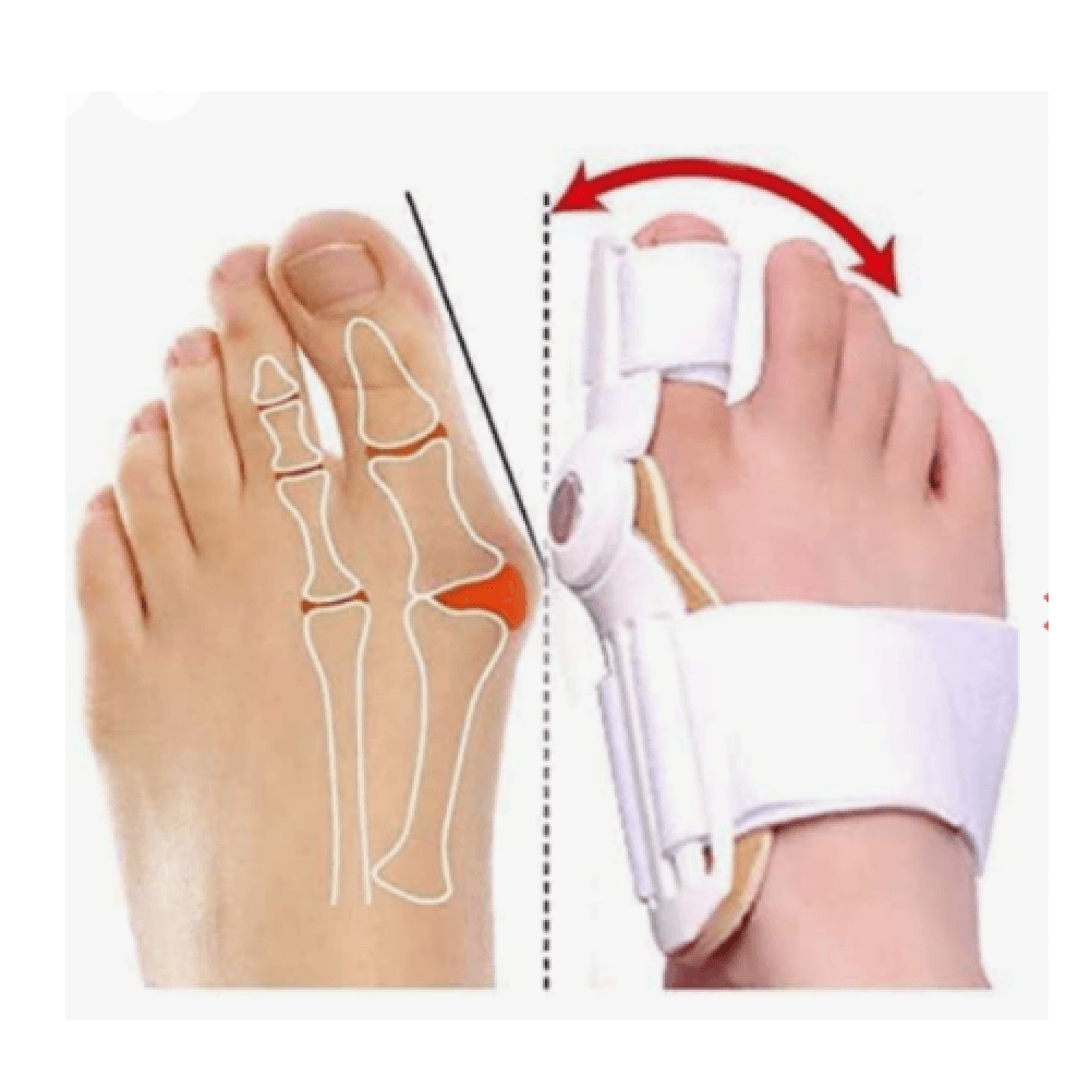 Big Toe Support, HTF 1001