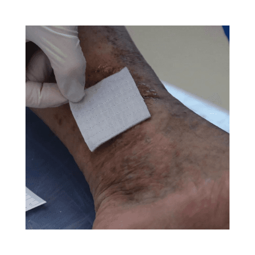 ضماد أكواسيل Ag بالفضة 15 × 15 سم
