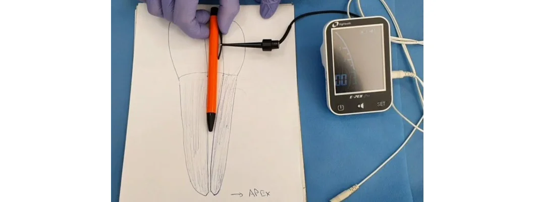 الدليل الكامل لشراء جهاز محدد الذروة لجذور الأسنان