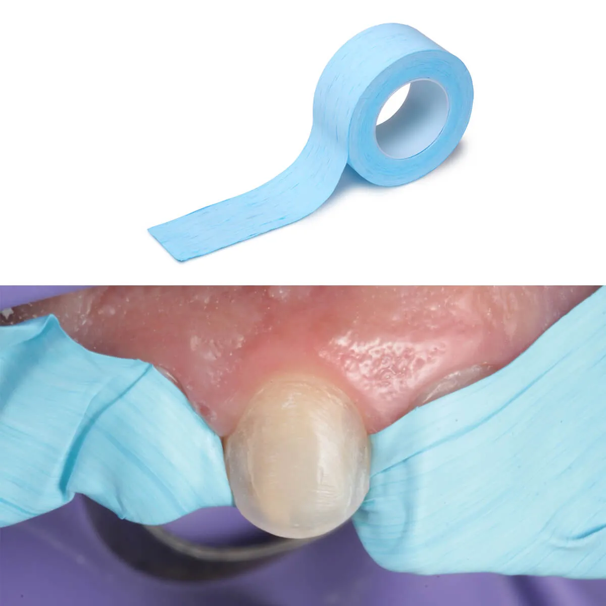 IsoTape شريط عزل الأسنان 5µm