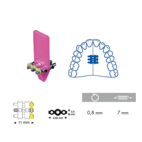 Orthodontic Standard Screw, Upper, 11 mm