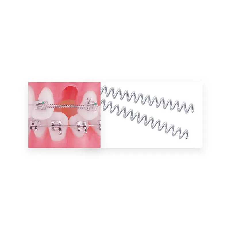 زنبرك ملفوف مفتوح TruFlex NiTi بكرة/7", 14x36, PK/3