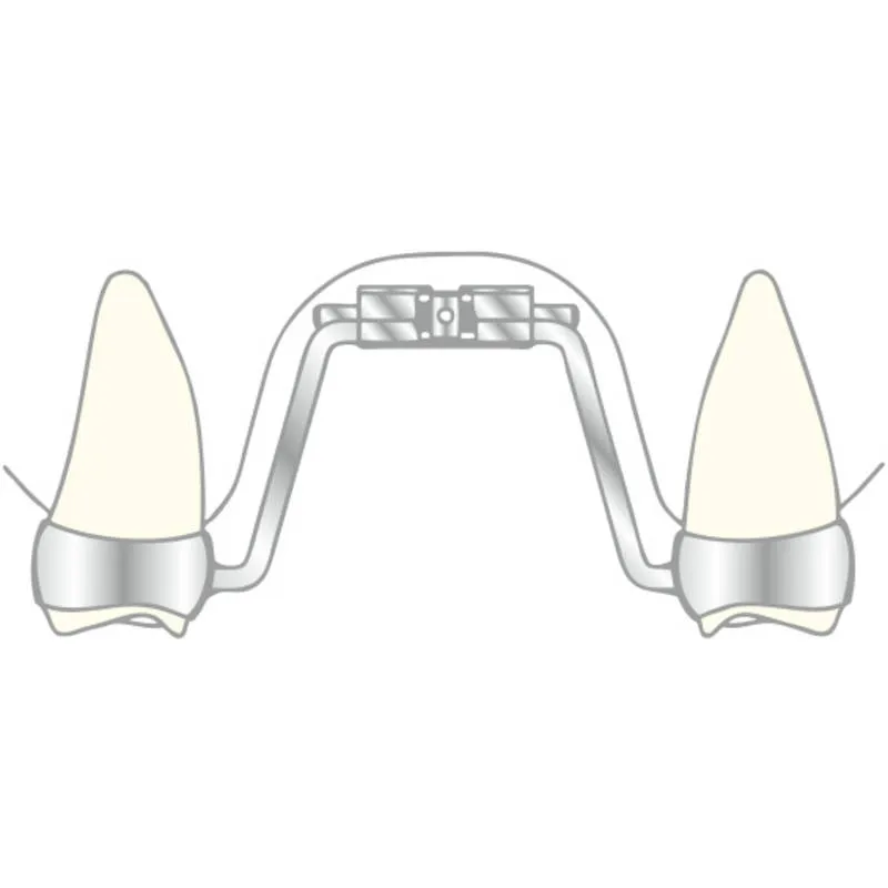 VECTOR 620, Skeletal Expanders, 11mm, PK/10