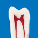 A12AN-200, Endodontic Tooth Model #11 - Nissin - A12AN-200#11