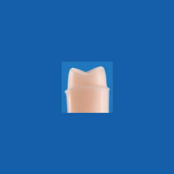 A25AN-UR61, Pre-Prepared Tooth #16 (Jacket) - Nissin - A25AN-UR61